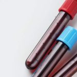 Novas exigências para licenciamento de irradiação de sangue e hemocomponentes publicadas no Diário Oficial da União Novas exigências para licenciamento de irradiação de sangue e hemocomponentes publicadas no Diário Oficial da União