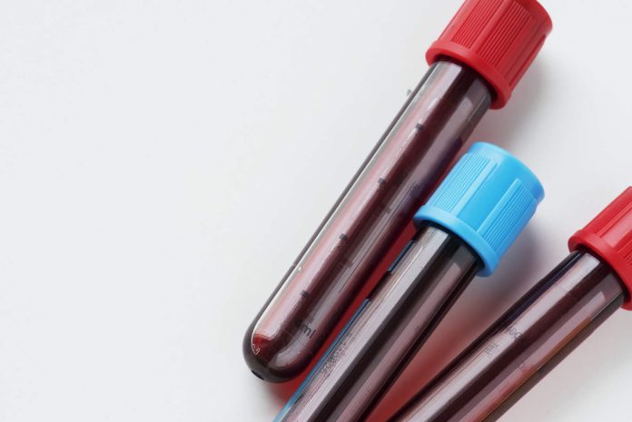 Novas exigências para licenciamento de irradiação de sangue e hemocomponentes publicadas no Diário Oficial da União