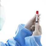 Quando ficar atento aos resultados do exame de PSA? Quando ficar atento aos resultados do exame de PSA?