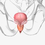 Dr. Heder Murari – Próstata aumentada precisa de tratamento? Dr. Heder Murari - Próstata aumentada precisa de tratamento?