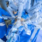 Prostatectomia robótica: precisão no tratamento do câncer de próstata Prostatectomia robótica: precisão no tratamento do câncer de próstata