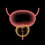 HoLEP: a cirurgia a laser para próstata aumentada que evita cortes e tem recuperação rápida Como é realizado a enucleação da próstata com laser de hólmio