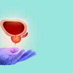 HoLEP no tratamento da hiperplasia prostática benigna: Dr. Marco Túlio Cruvinel, urologista em Goiânia, comenta os avanços clínicos da técnica HoLEP no tratamento da hiperplasia prostática benigna Dr. Marco Túlio Cruvinel, urologista em Goiânia, comenta os avanços clínicos da técnica