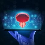 Holep: a cirurgia a laser que redefine o tratamento da próstata aumentada Qual a melhor opção de cirurgia a laser para próstatas de grande volume