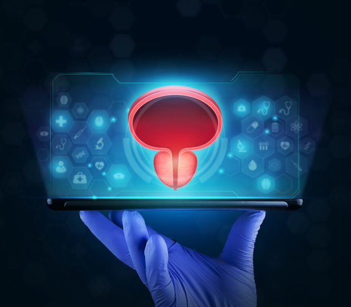 Qual a melhor opção de cirurgia a laser para próstatas de grande volume