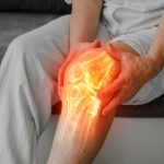 Artrose no joelho: sinais de que o tratamento clínico não é mais suficiente Artrose no joelho Veja quando pode ser hora de pensar em uma prótese